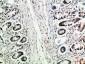 MCP-3 Polyclonal Antibody